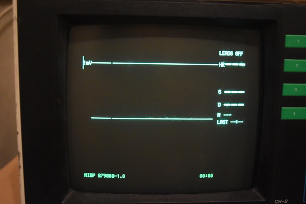 What's inside a vitals monitor